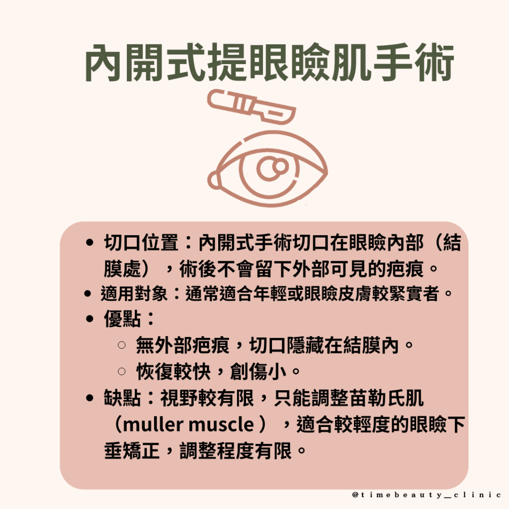 內開式提眼瞼肌，外開式提眼瞼肌