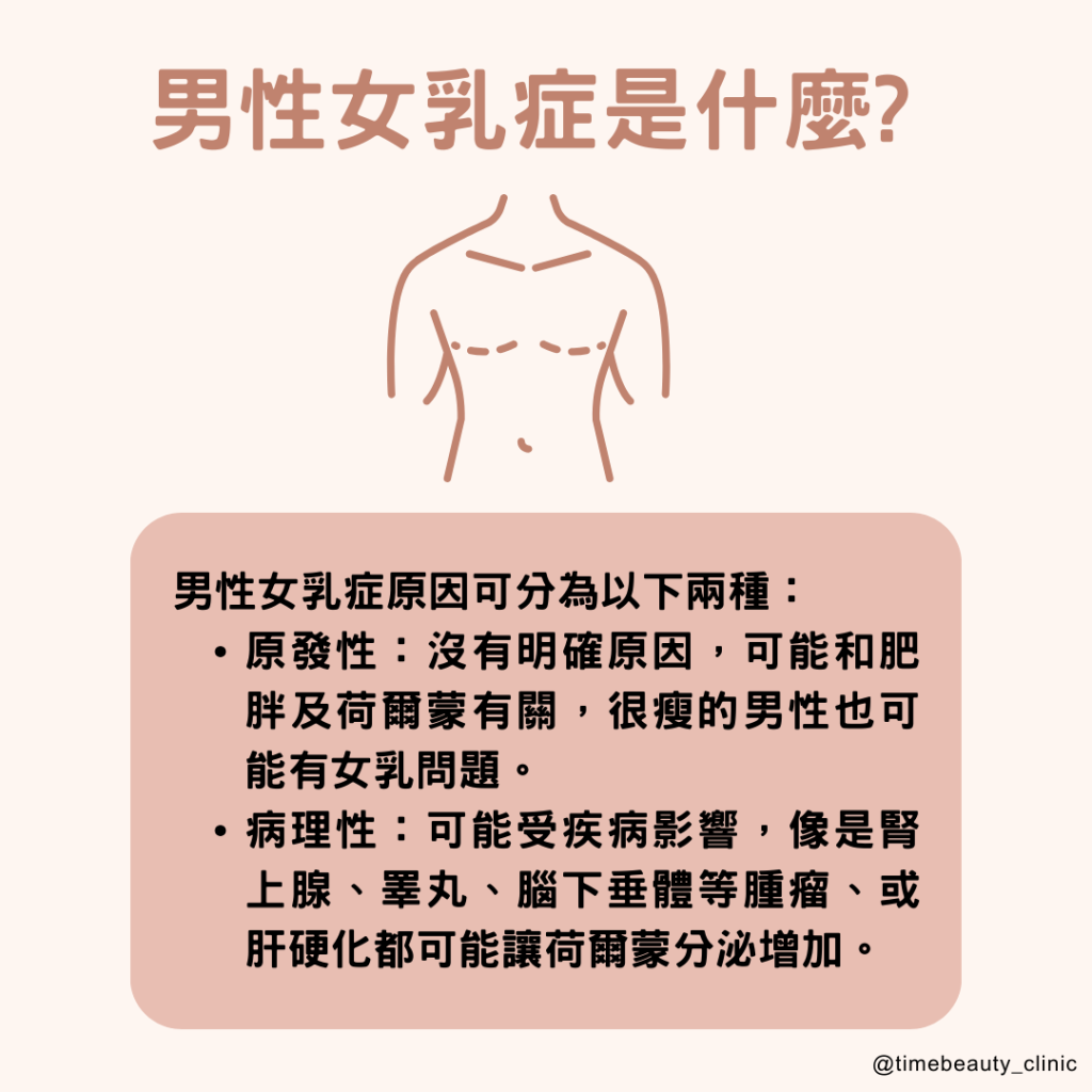 男性女乳症費用